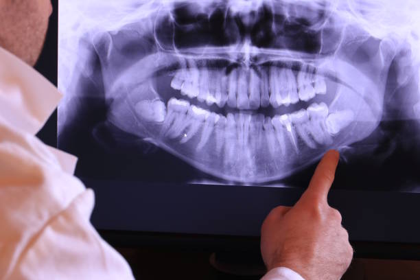 Best Emergency Dental Care for Abscessed Tooth in Ashton, ID